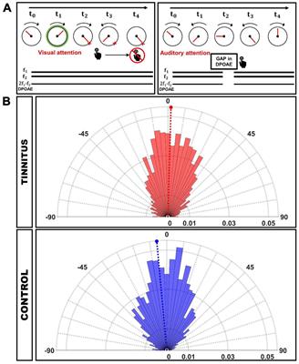The corticofugal oscillatory modulation of the cochlear receptor during auditory and visual attention is preserved in tinnitus